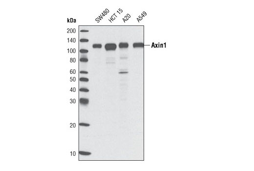 Western Blotting Image 1: Axin1 (C76H11) Rabbit mAb