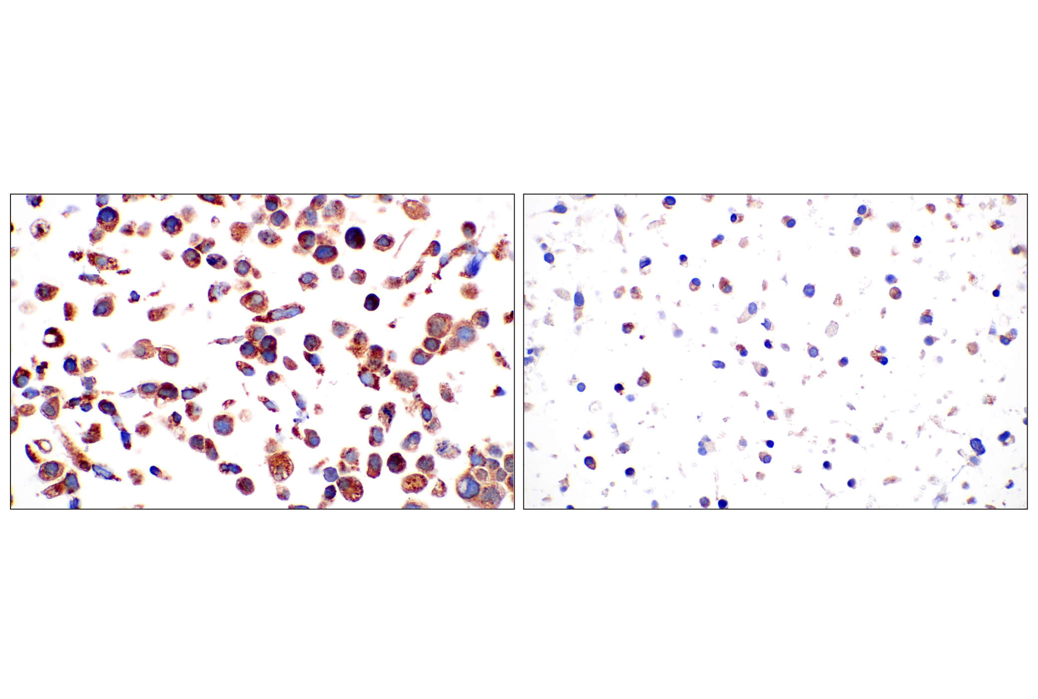 Immunohistochemistry Image 10: Frataxin (F4V2S) Rabbit mAb (BSA and Azide Free)