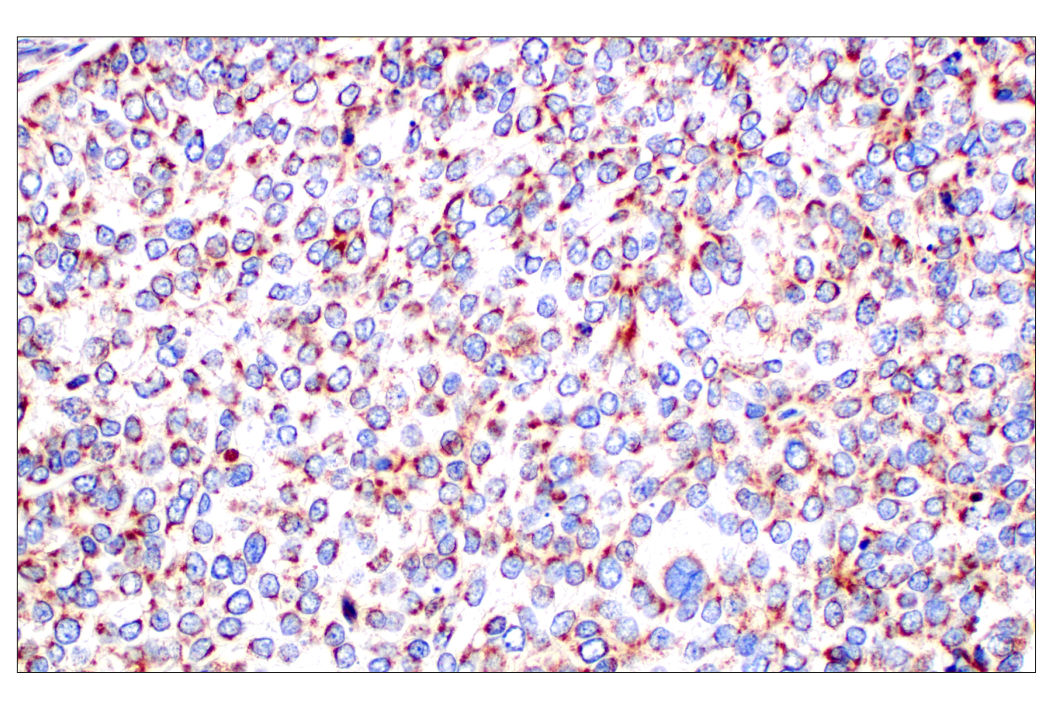 Immunohistochemistry Image 5: Frataxin (F4V2S) Rabbit mAb (BSA and Azide Free)