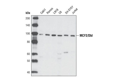 Western Blotting Image 1: MCF2/Dbl Antibody