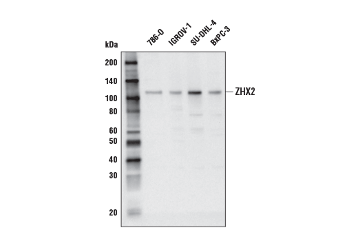Western Blotting Image 1: ZHX2 Antibody