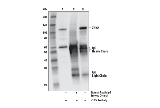 Immunoprecipitation Image 1: ZHX2 Antibody