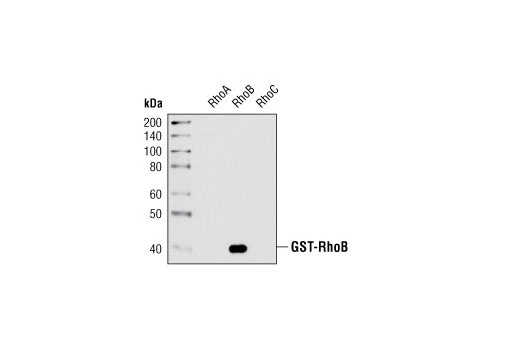  Image 8: Rho-GTPase Antibody Sampler Kit