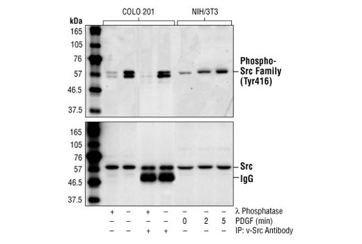 Western Blotting Image 1: Phospho-Src Family (Tyr416) Antibody