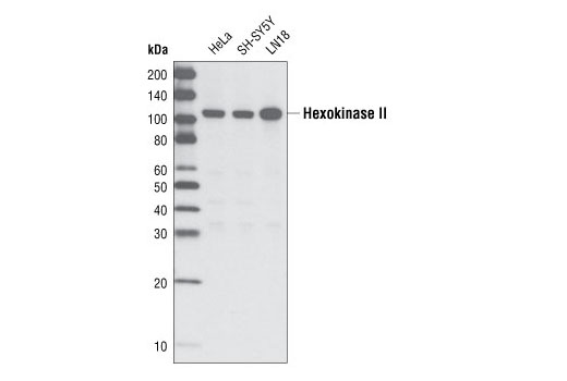 Western Blotting Image 1: Hexokinase II Antibody