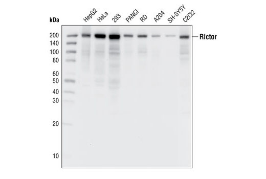  Image 1: PhosphoPlus® Rictor (Thr1135) Antibody Duet