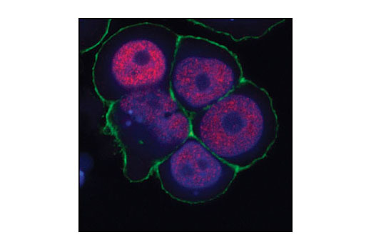 Immunofluorescence Image 1: SRC-3 (11B1) Mouse mAb
