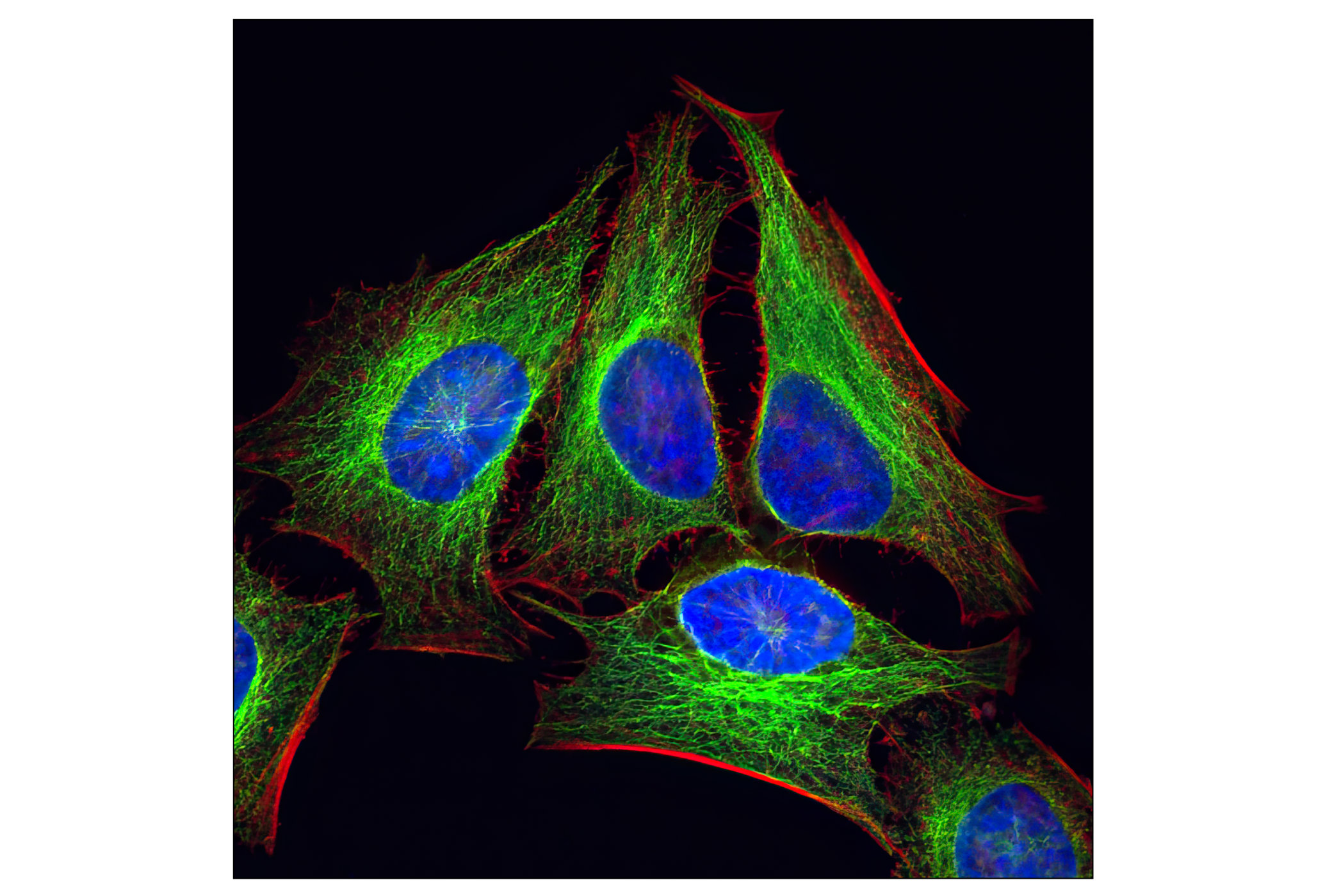 Immunofluorescence Image 1: α-Tubulin (11H10) Rabbit mAb
