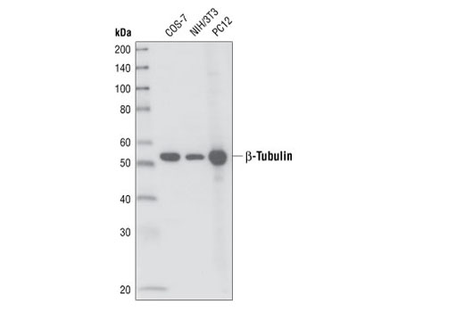 Western Blotting Image 1: β-Tubulin (9F3) Rabbit mAb
