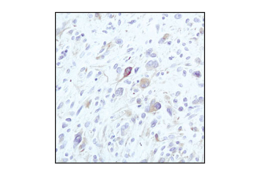 Immunohistochemistry Image 1: β-Tubulin (9F3) Rabbit mAb