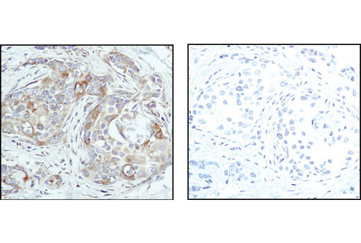 Immunohistochemistry Image 4: β-Tubulin (9F3) Rabbit mAb