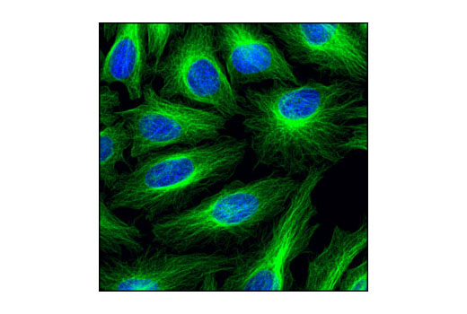 Immunofluorescence Image 1: β-Tubulin (9F3) Rabbit mAb