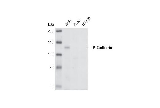 Western Blotting Image 1: P-Cadherin Antibody