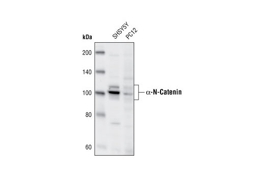 Western Blotting Image 1: α-N-Catenin Antibody
