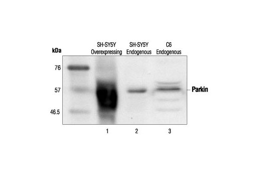 Western Blotting Image 2: Parkin Antibody