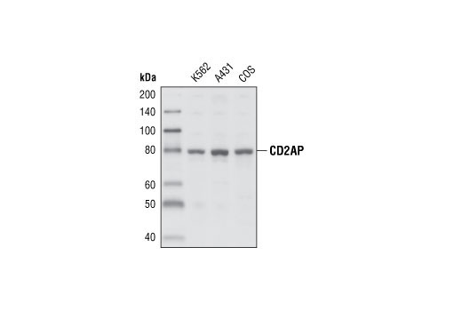 Western Blotting Image 1: CD2AP Antibody