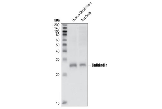 Western Blotting Image 1: Calbindin Antibody