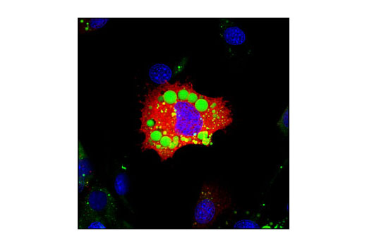 Immunofluorescence Image 1: ATGL Antibody