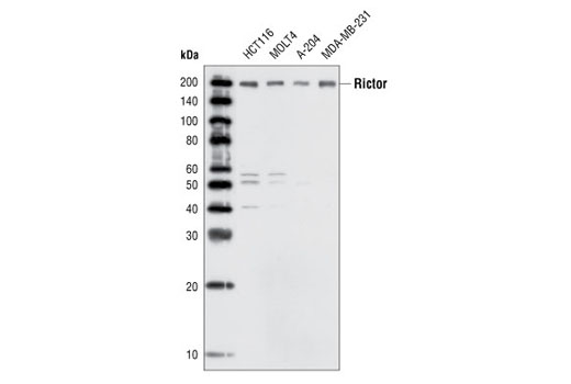 Western Blotting Image 1: Rictor Antibody