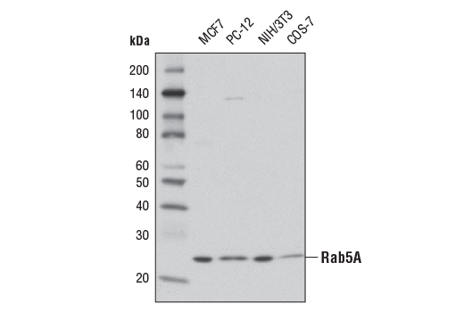 Western Blotting Image 1: Rab5A Antibody