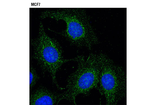 Immunofluorescence Image 1: Rab5A Antibody