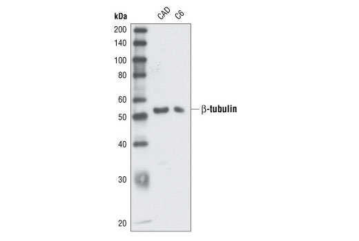 Western Blotting Image 2: β-Tubulin Antibody