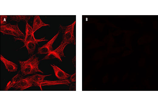 Immunofluorescence Image 1: β-Tubulin Antibody