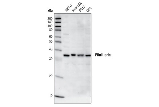 Western Blotting Image 1: Fibrillarin (T298) Antibody