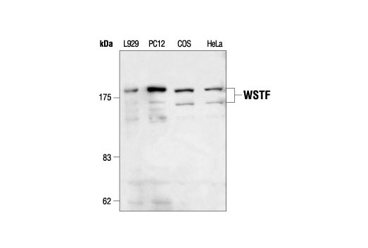 Western Blotting Image 1: WSTF Antibody