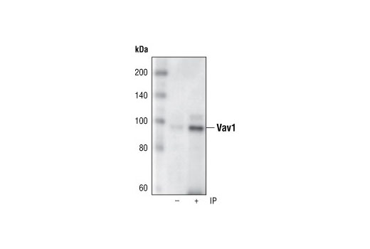 Immunoprecipitation Image 1: Vav1 (R775) Antibody
