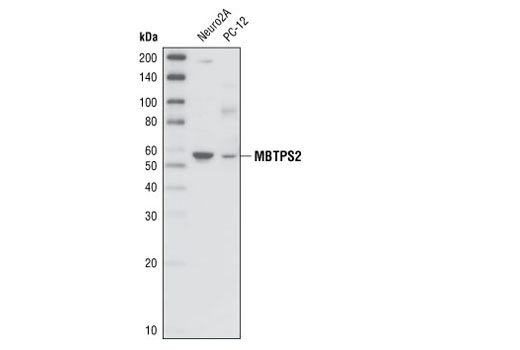 Western Blotting Image 1: MBTPS2 Antibody