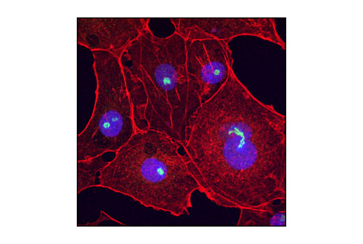 Immunofluorescence Image 1: Fibrillarin (R122) Antibody (IF Specific)