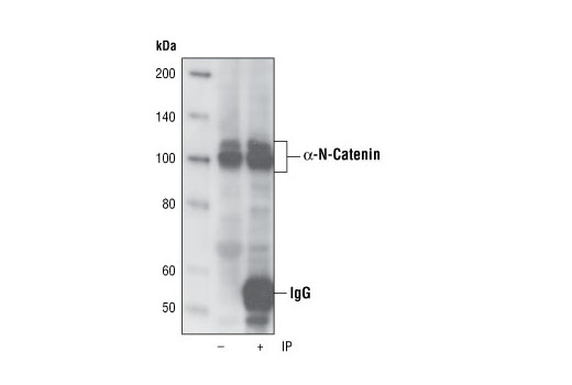 Immunoprecipitation Image 1: α-N-Catenin (C12G4) Rabbit mAb