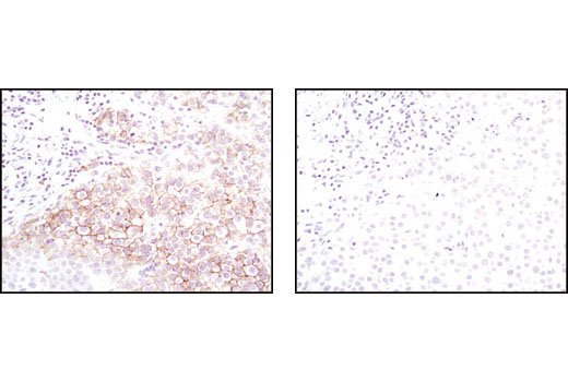 Immunohistochemistry Image 1: HER2/ErbB2 (29D8) Rabbit mAb (BSA and Azide Free)