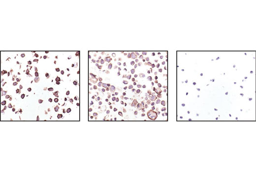Immunohistochemistry Image 3: HER2/ErbB2 (29D8) Rabbit mAb (BSA and Azide Free)