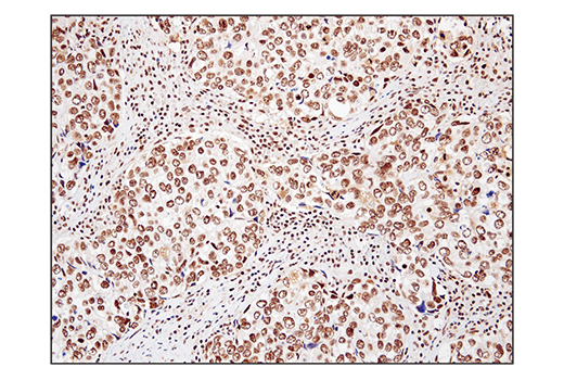  Image 34: BAF Complex IHC Antibody Sampler Kit