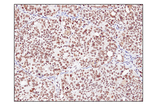  Image 41: BAF Complex IHC Antibody Sampler Kit