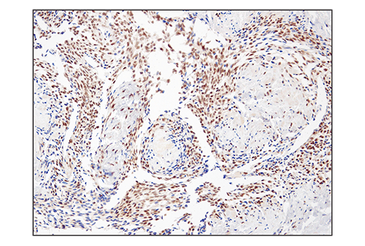  Image 53: BAF Complex IHC Antibody Sampler Kit