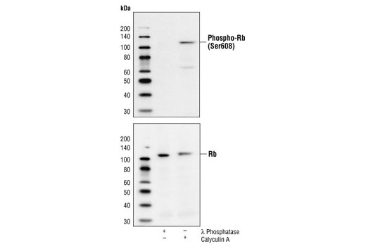 Western Blotting Image 1: Phospho-Rb (Ser608) Antibody