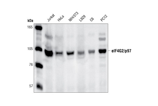Western Blotting Image 1: eIF4G2/p97 Antibody