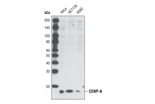Western Blotting Image 1: CENP-A Antibody