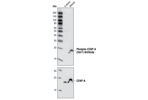 Western Blotting Image 1: Phospho-CENP-A (Ser7) Antibody