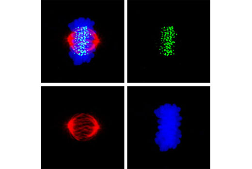 Immunofluorescence Image 1: Phospho-CENP-A (Ser7) Antibody