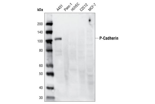  Image 5: Cadherin-Catenin Antibody Sampler Kit