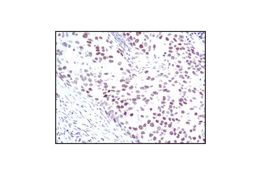 Immunohistochemistry Image 1: SRC-1 (128E7) Rabbit mAb