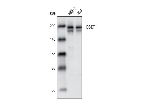  Image 2: Lysine Methyltransferase Antibody Sampler Kit