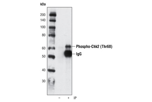  Image 3: PhosphoPlus® Chk2 (Thr68) Antibody Duet