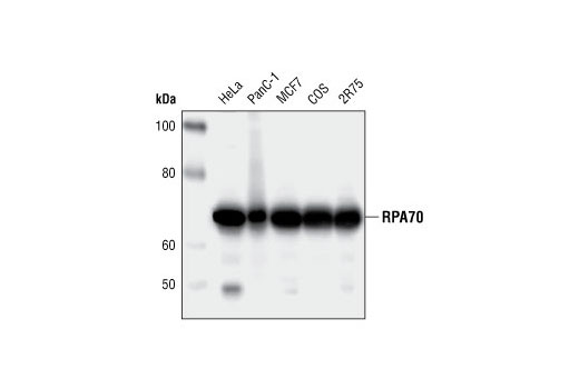 Western Blotting Image 1: RPA70/RPA1 (4D9) Rat mAb