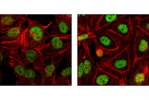 Immunofluorescence Image 1: RPA70/RPA1 (4D9) Rat mAb