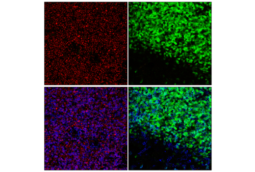 Immunofluorescence Image 1: TCF1/TCF7 (C63D9) Rabbit mAb